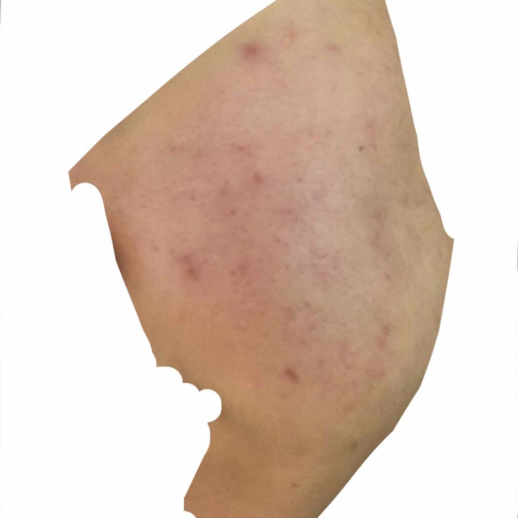 さき on LIPS 「誰か助けてください😭😭..」(2枚目)