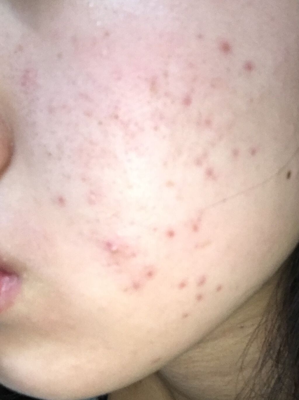 CICA ケアクリーム/BEAUSTA/フェイスクリームを使ったクチコミ（2枚目）