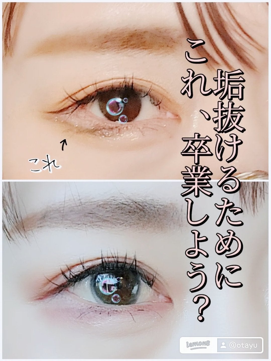 ããã!𫊠on LIPS ãããã§ãããŒãèŠããããã®ã¿ã¬ç®å°é·ã©ã€ã³ç§ã6.7幎ãããå..ãïŒ1æç®ïŒ