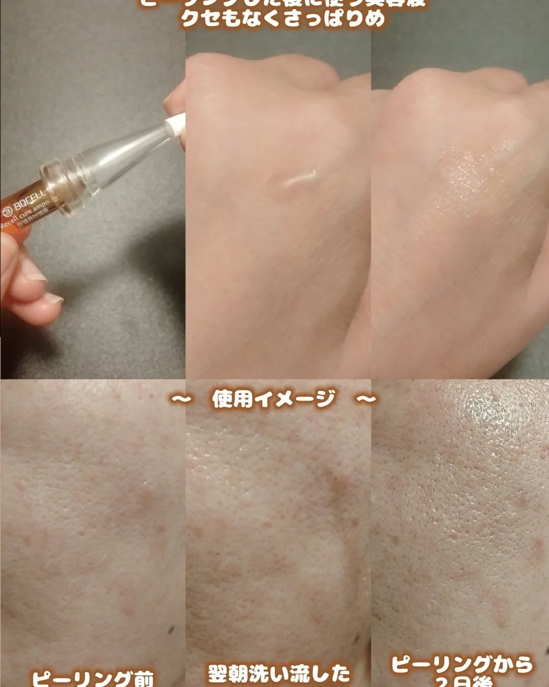 ダーマスキンピーリング/BQCELL/その他キットセットを使ったクチコミ(3枚目)