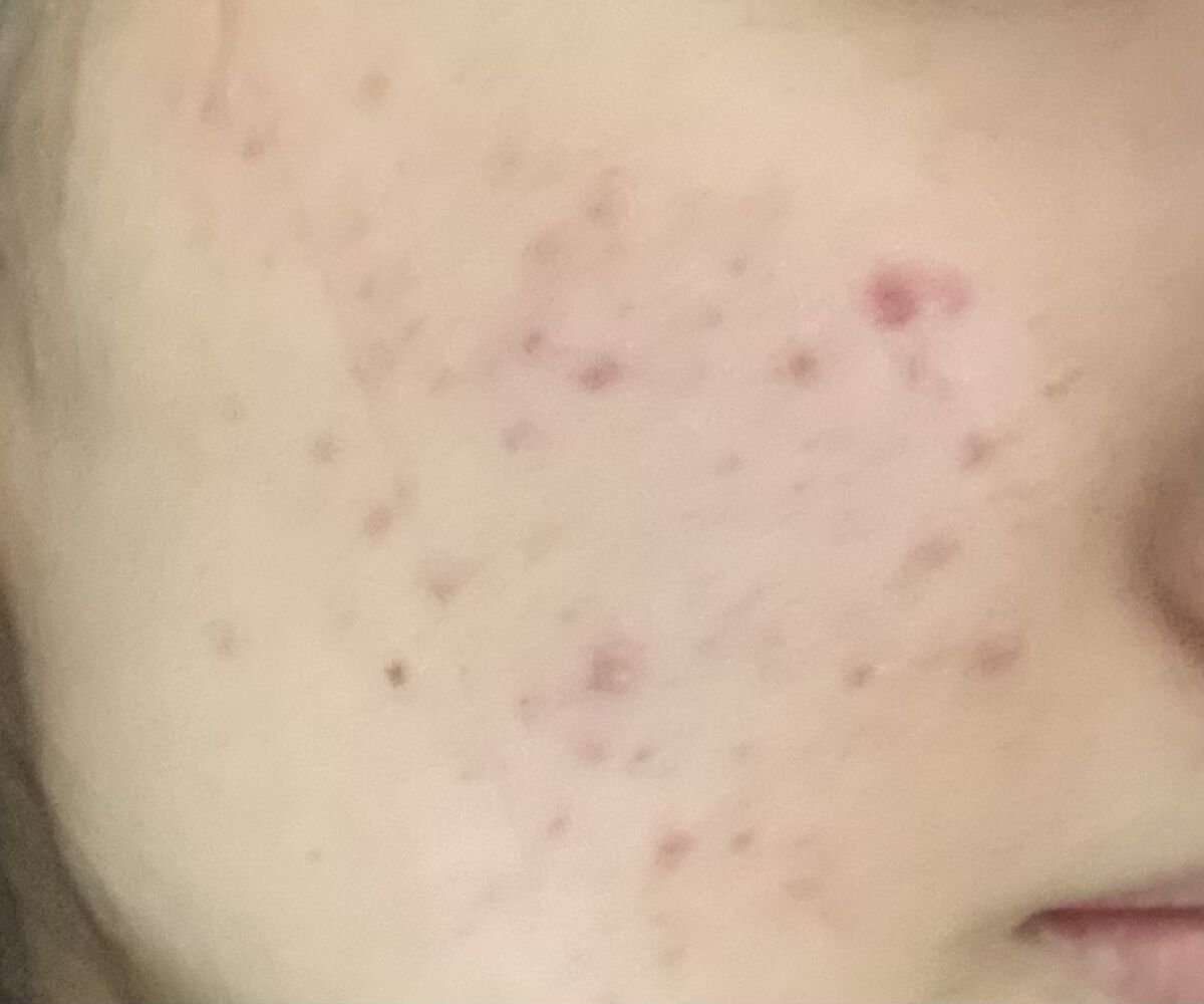 白潤 薬用美白化粧水/肌ラボ/化粧水を使ったクチコミ（2枚目）