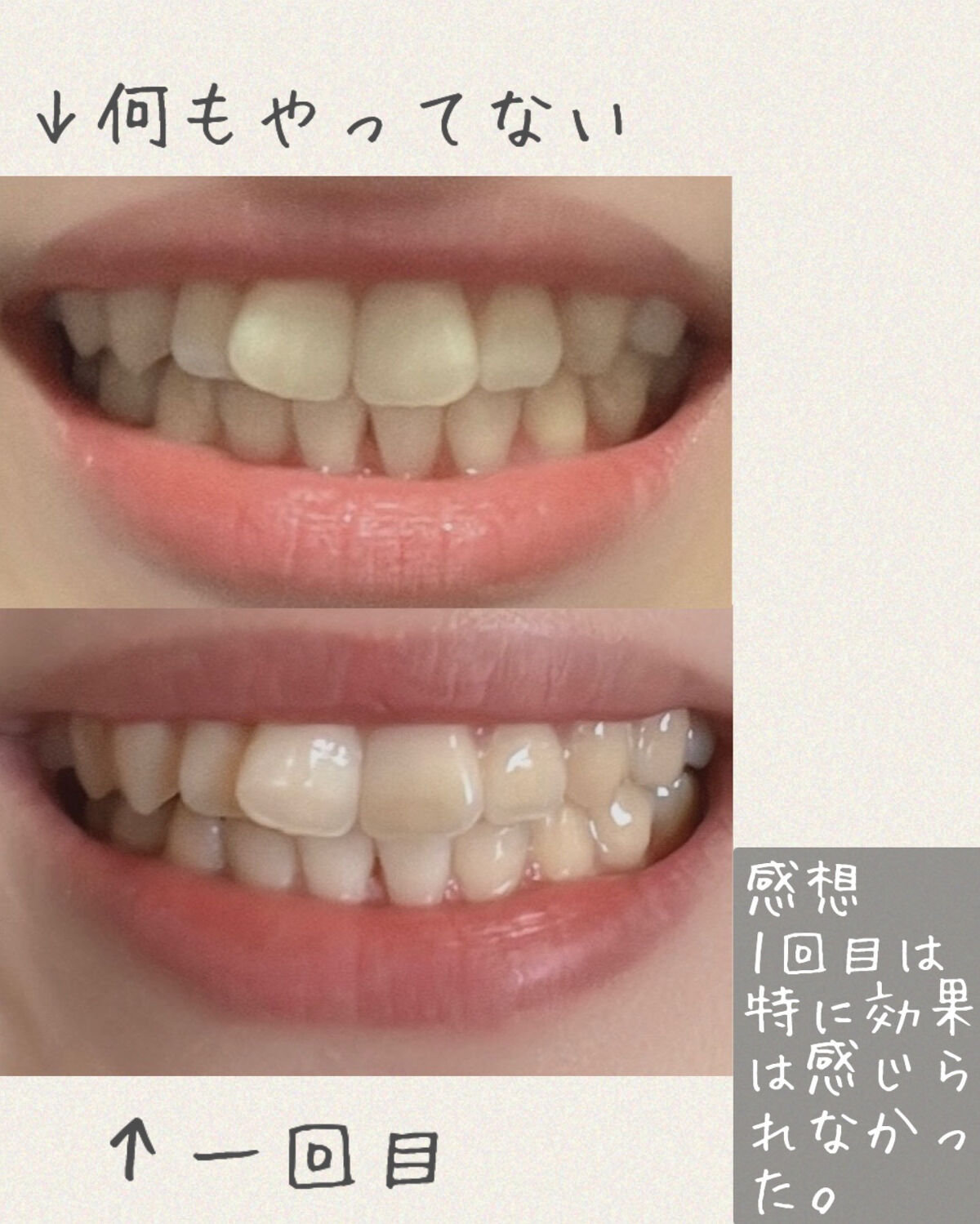 クレスト3Dホワイトニング ホワイトストリップ プロフェッショナル エフェクツ/クレスト/その他オーラルケアを使ったクチコミ（2枚目）