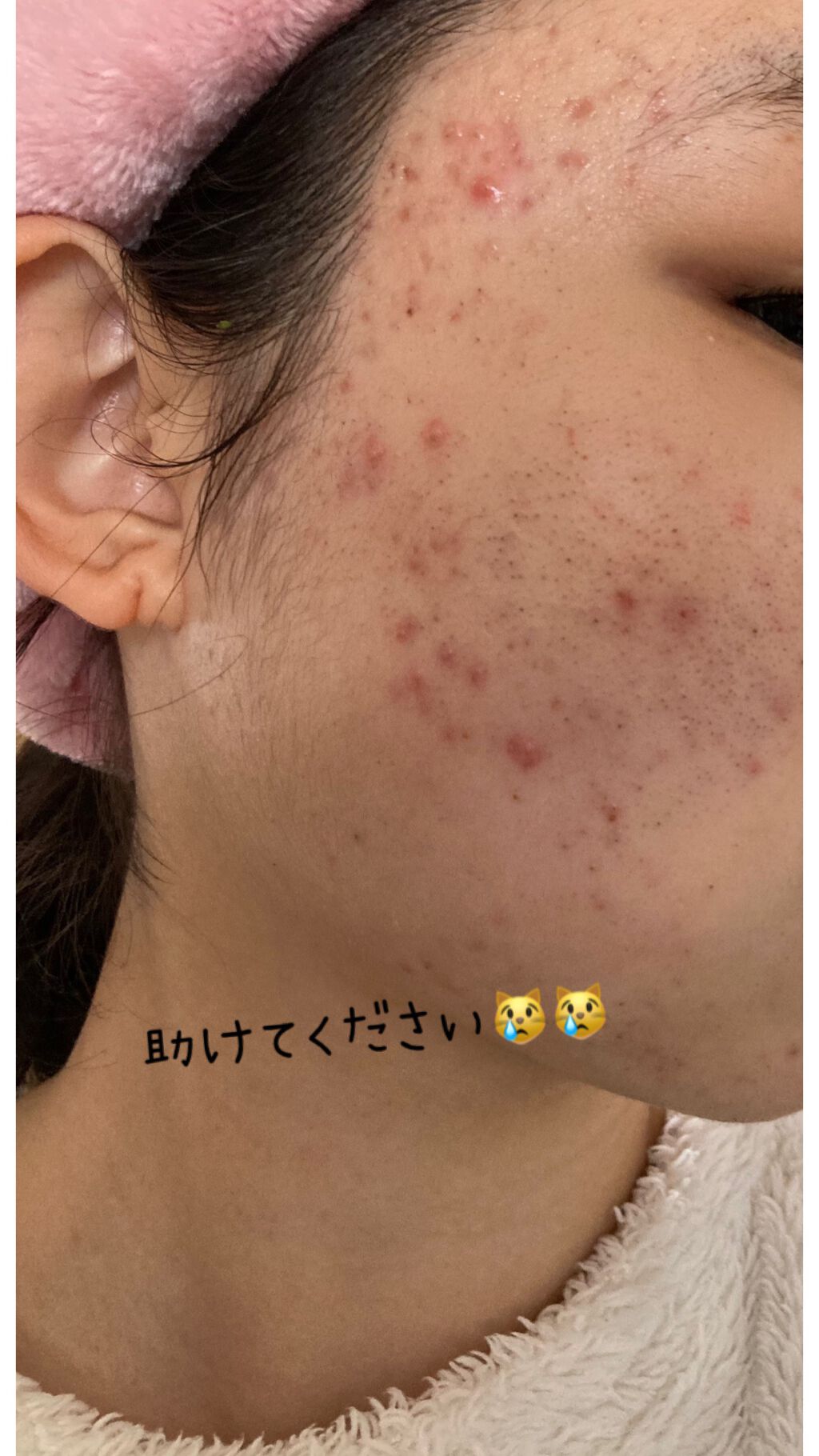 ネイチャーコンク 薬用クリアローション/ネイチャーコンク/拭き取り化粧水を使ったクチコミ(1枚目)