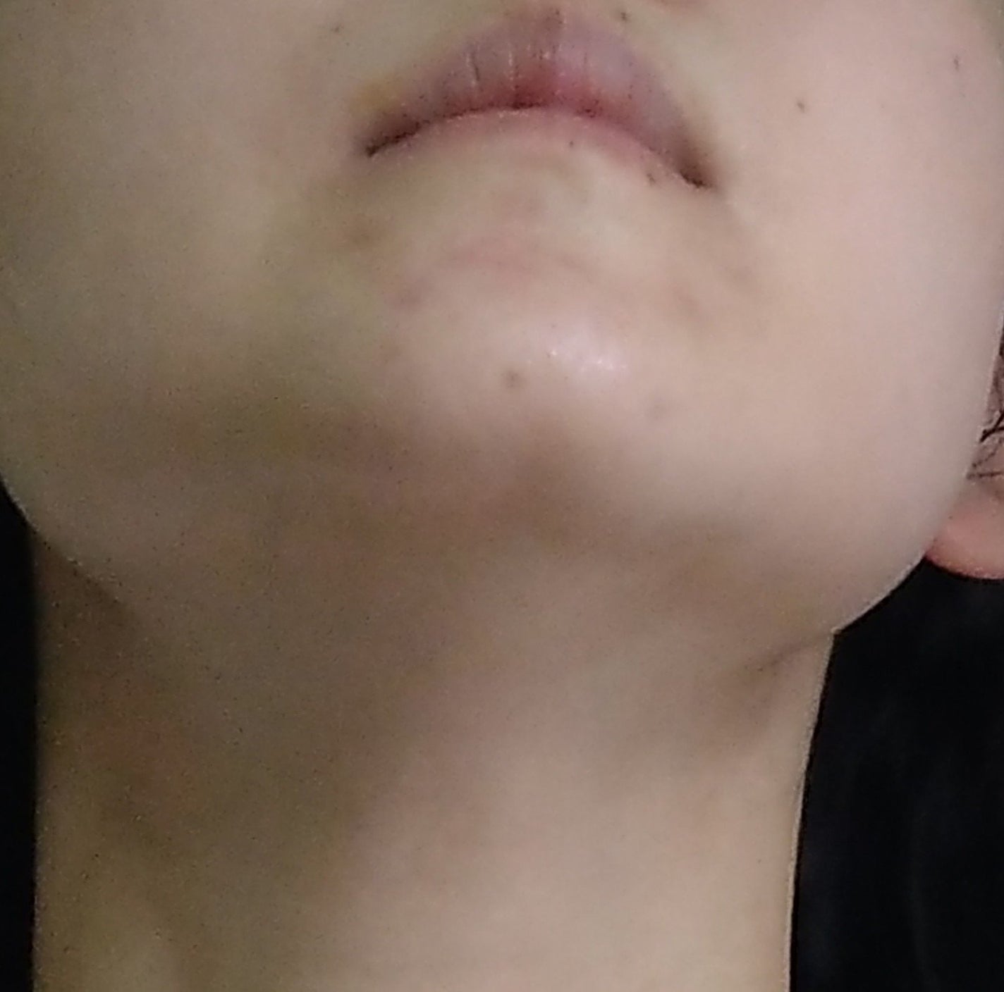 モイストバランス ローション/ACSEINE/化粧水を使ったクチコミ(3枚目)