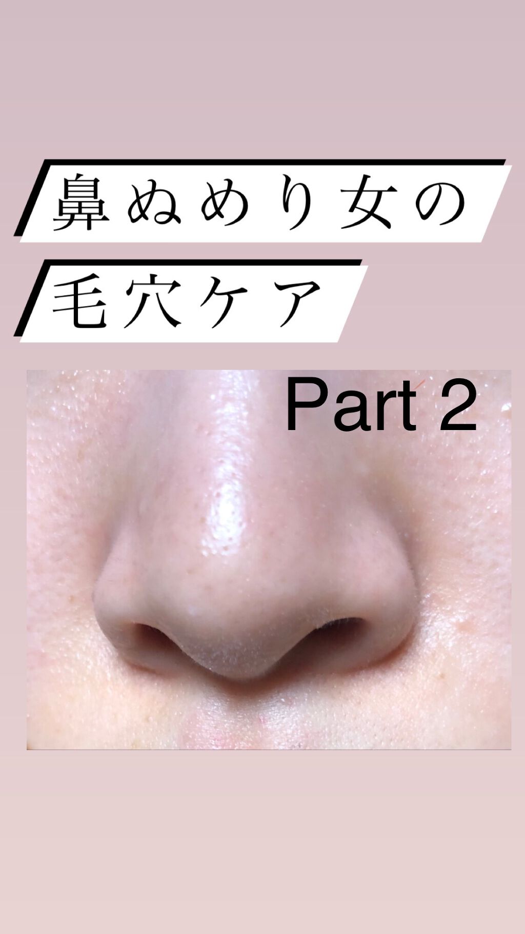 謎に鼻の脂が凄すぎる私の毛穴ケア紹介です。

今回はDUO 黄色(がちレポです、広告じゃないです笑)

正直DUOは広告多過ぎてバカにしてました笑
実際しょーもないんだろとか思ってましたすんません。

買って使ってみたら、すぐに効果が現れた