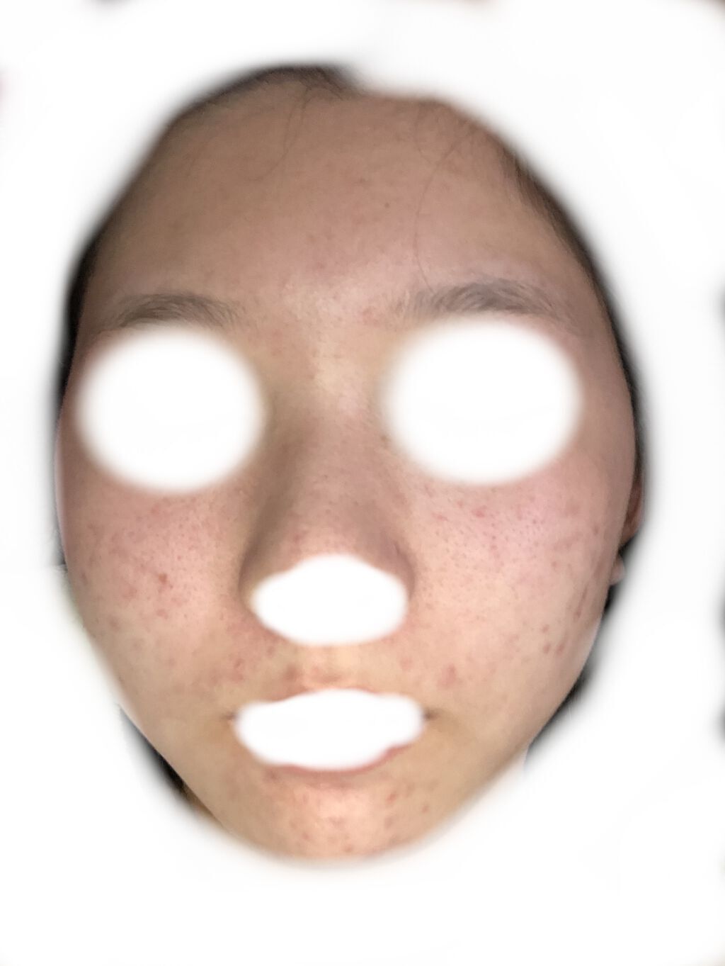 モイストボタニカル 化粧水R/unlabel/化粧水を使ったクチコミ（2枚目）