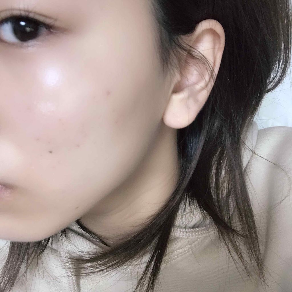 薬用 しみ 集中対策 美容液/メラノCC/美容液を使ったクチコミ(2枚目)