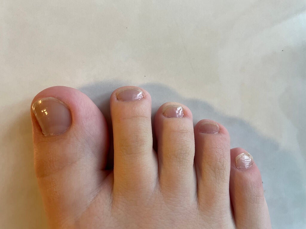 ネイルケアプロテクター/オルビス/ネイルオイル・トリートメントを使ったクチコミ(2枚目)