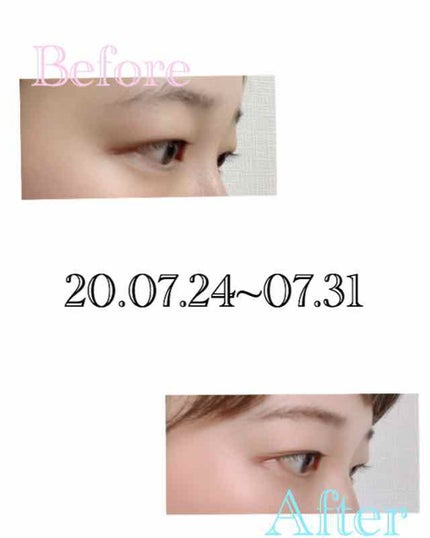 スカルプD ボーテ ピュアフリーアイラッシュセラム/アンファー(スカルプD)/まつげ美容液を使ったクチコミ(3枚目)