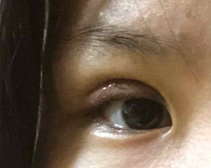 アイトーク/アイトーク/二重まぶた用アイテムを使ったクチコミ(4枚目)