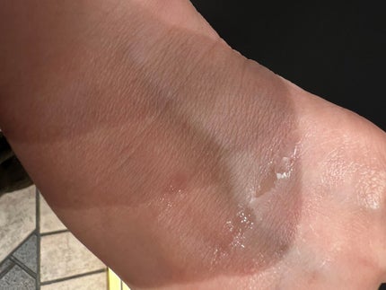 モイストローション/WHOMEE/化粧水を使ったクチコミ(3枚目)