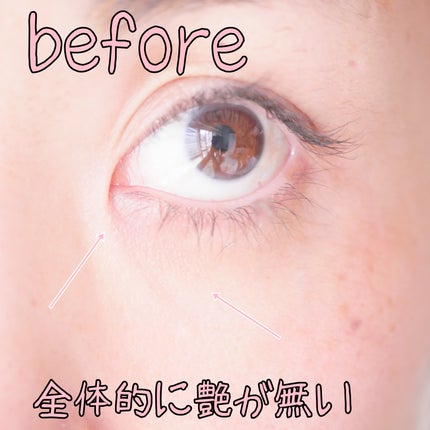 ファイン100/imini/美容液を使ったクチコミ(5枚目)