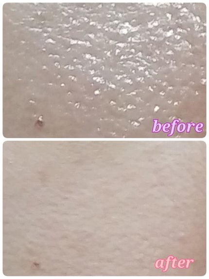 【旧品】マシュマロフィニッシュパウダー/キャンメイク/プレストパウダーを使ったクチコミ(4枚目)