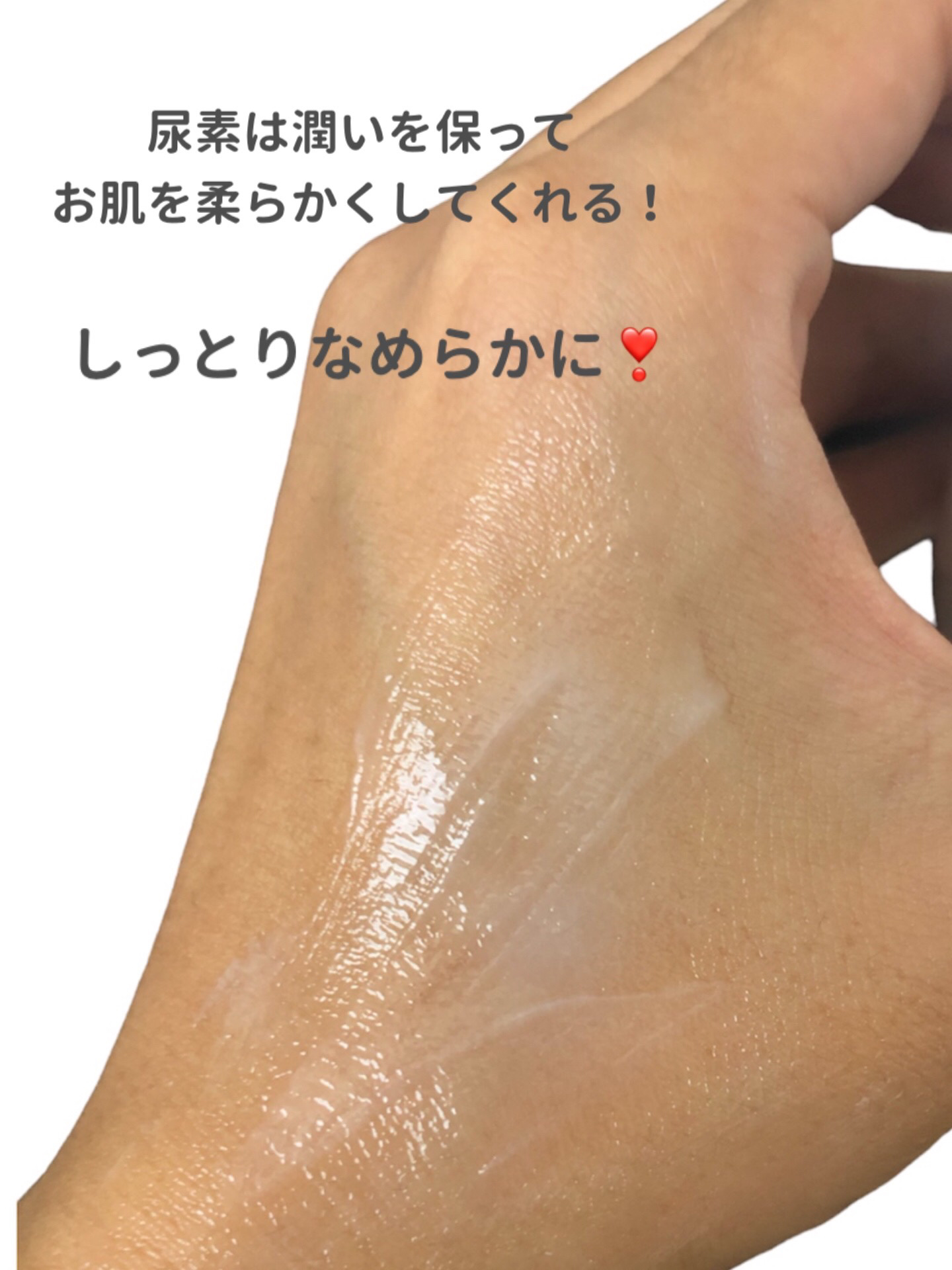 ケトパラミン20E(医薬品)/ラクール/その他を使ったクチコミ（3枚目）