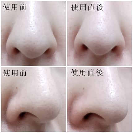 鼻 バブルパック/CNP Laboratory/シートマスク・パックを使ったクチコミ(3枚目)