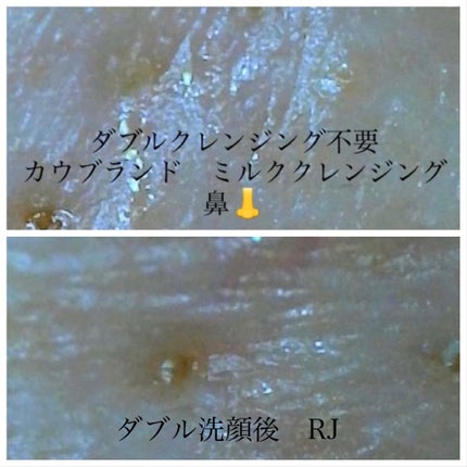 RJ トライアルセット/アピセラピーコスメティクス/スキンケアキットを使ったクチコミ(2枚目)