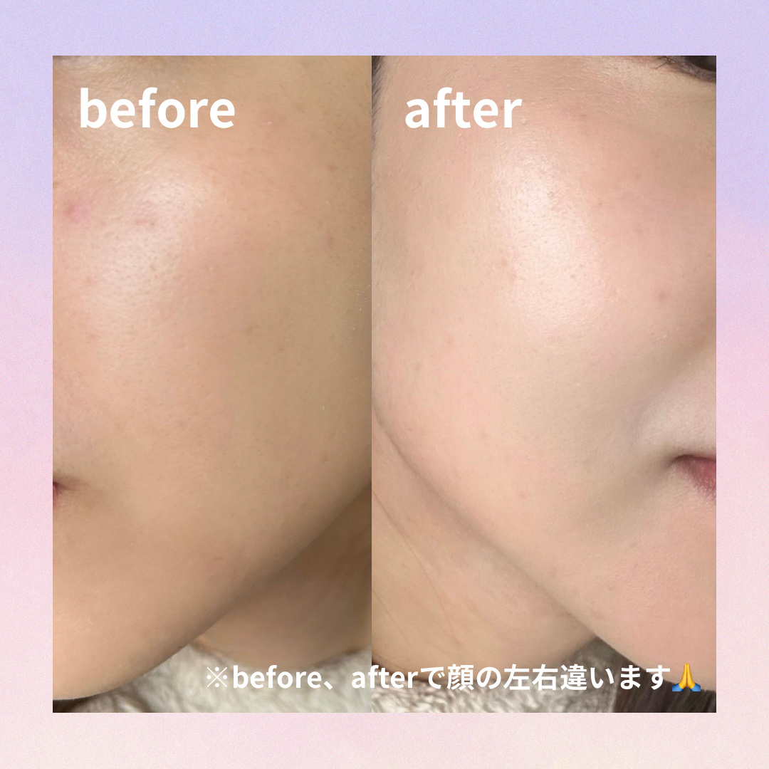 ミネラル 薬用プライマーベース グリーン（サンリオクロミデザイン）/TIME SECRET/化粧下地を使ったクチコミ（2枚目）