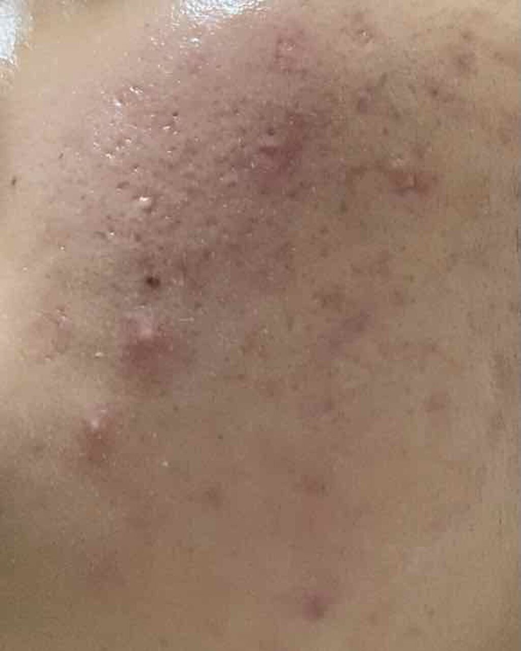 潤浸保湿 乳液/キュレル/乳液を使ったクチコミ(3枚目)