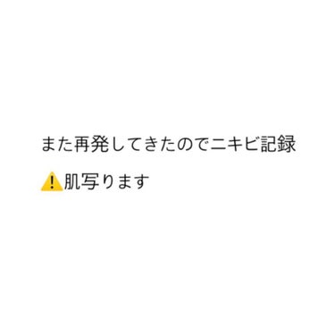 ニキビ　2021.5.3

肌荒れのサロンに行ってきたのですが、ピーリング結局してないにもかかわらず、何故か肌がピリピリしていました。(そこのクレンジングとか施術が合わなかったのか？)
でもサロンのクレ