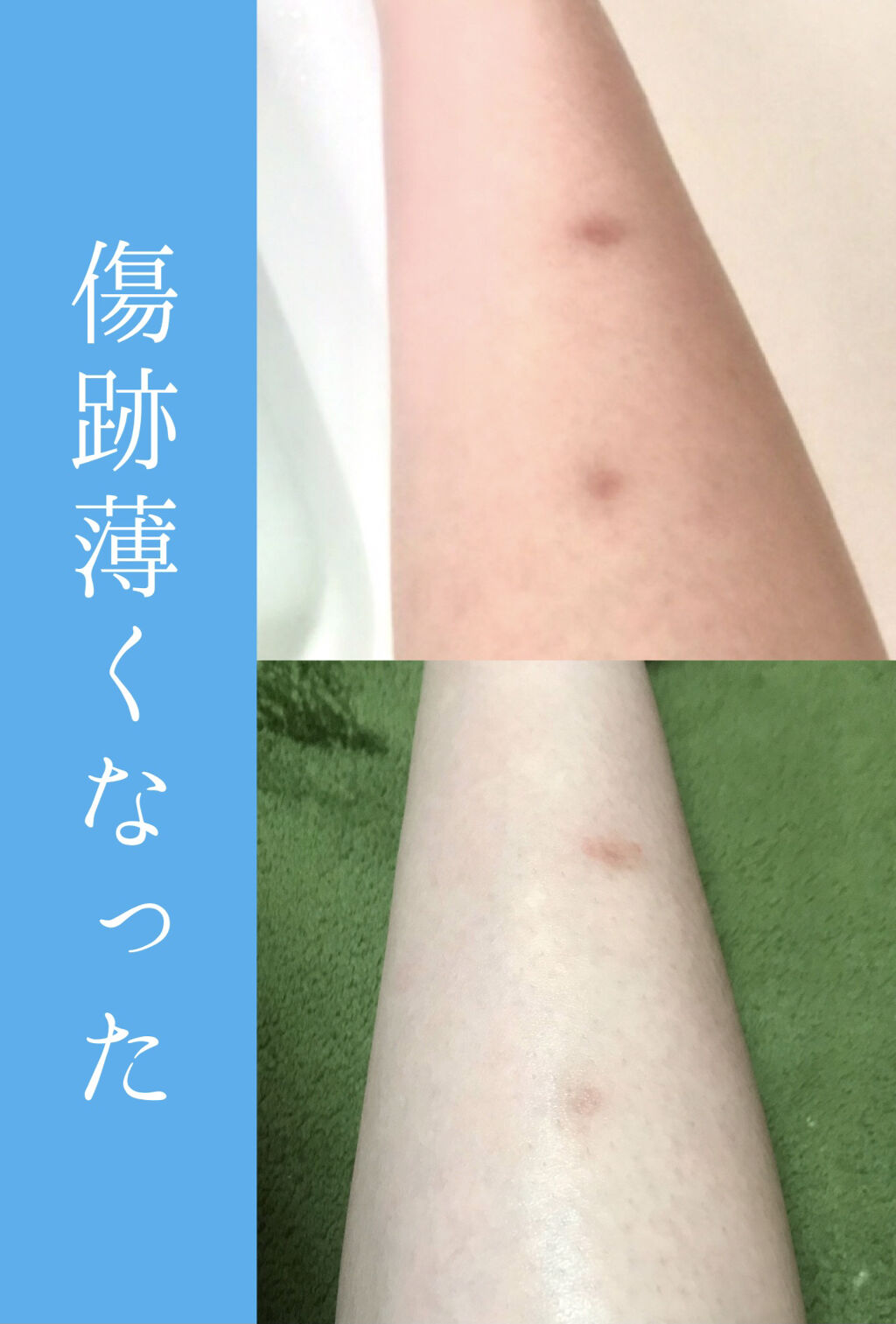 100LAAインパウダー/The Ordinary/その他スキンケアを使ったクチコミ（1枚目）