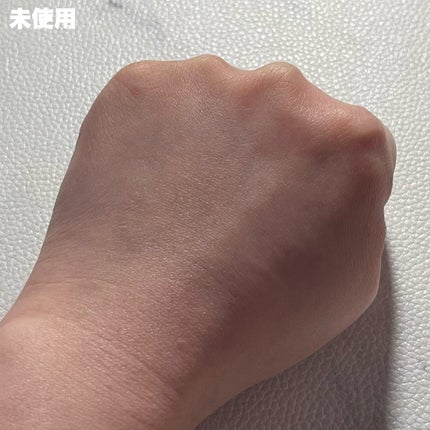 ミラクルクリアスージングスポットジェル/Rael/にきびパッチを使ったクチコミ(5枚目)