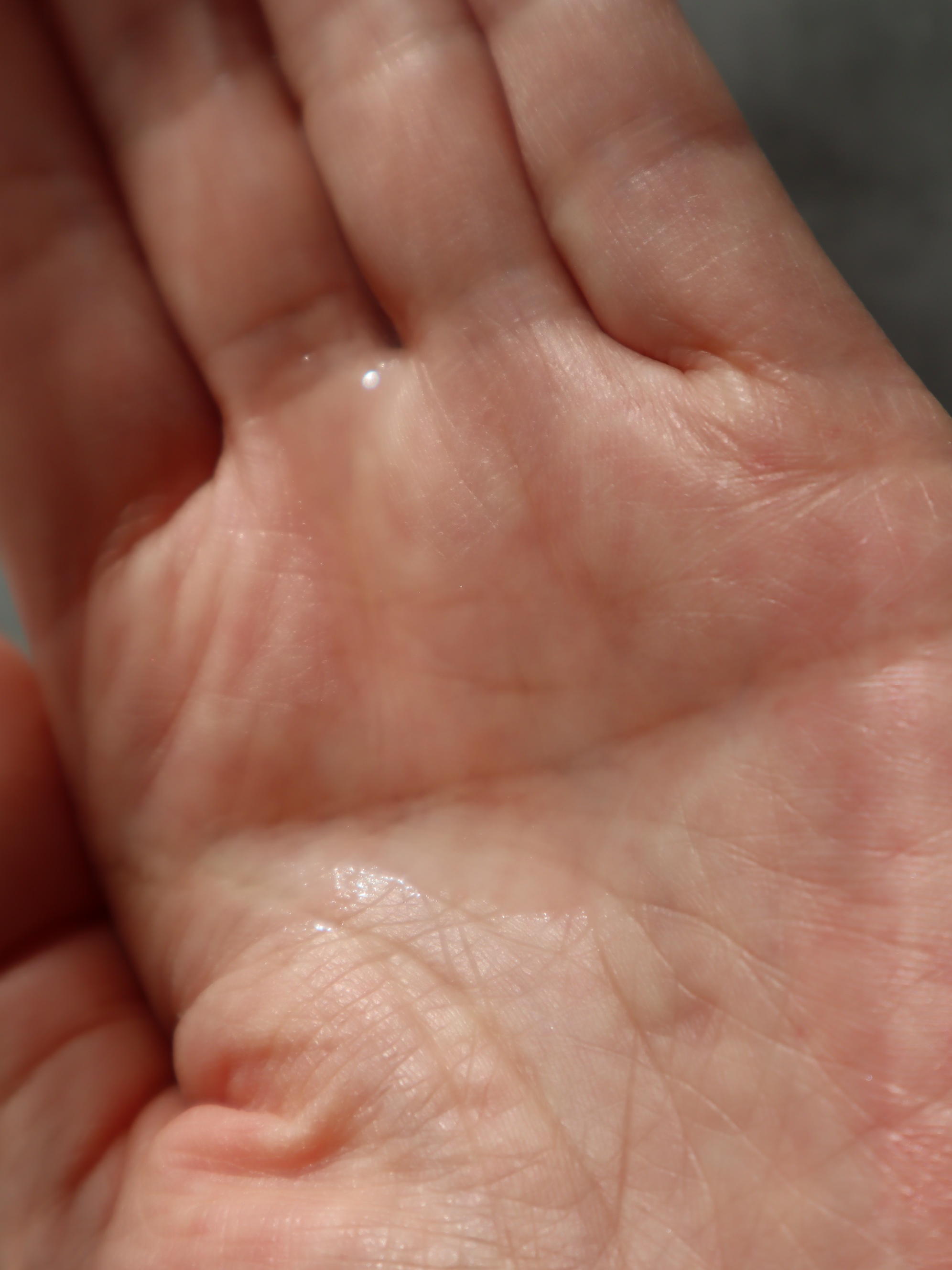 p/d ローションプラス/p/d/化粧水を使ったクチコミ（3枚目）