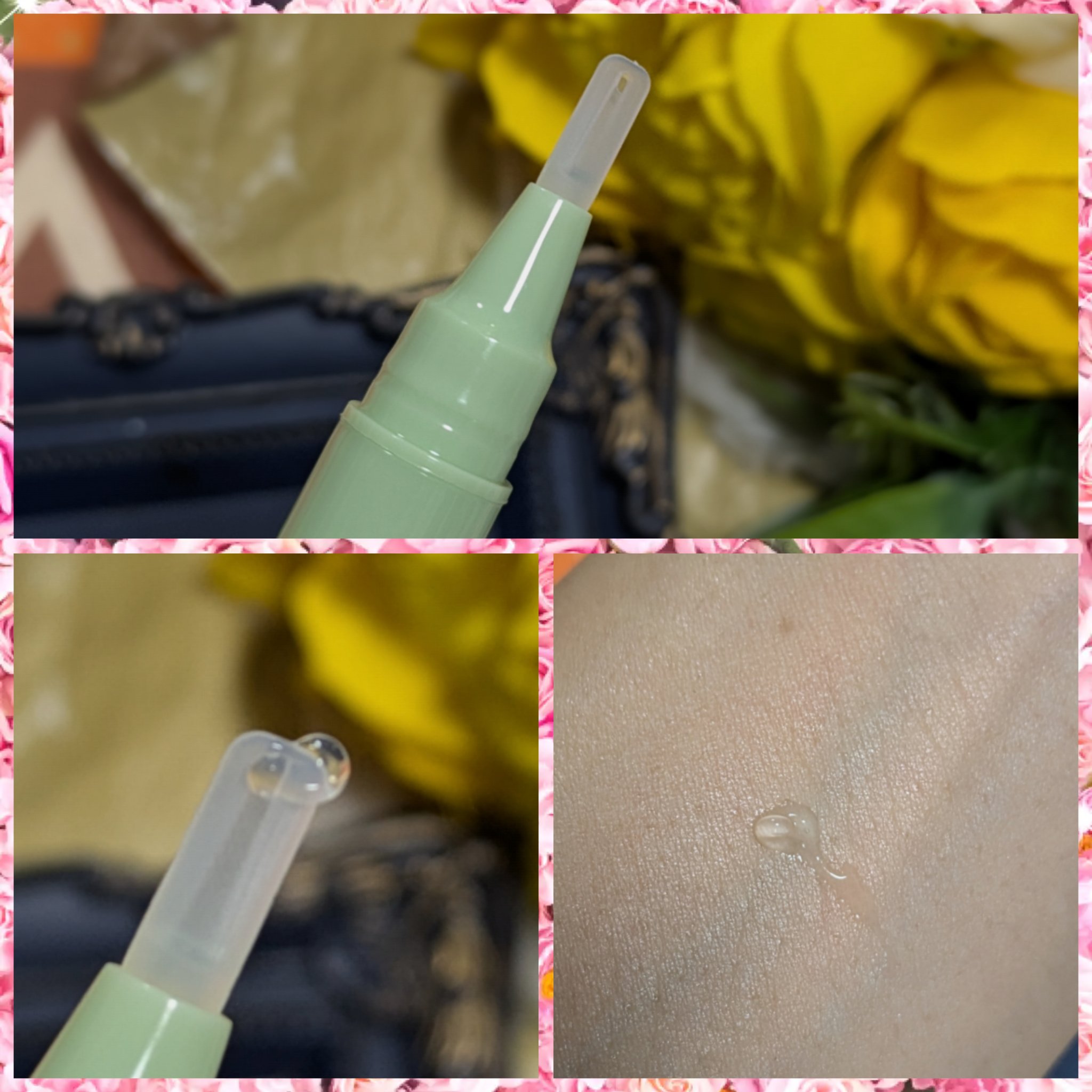 ミラクルクリアスージングスポットジェル/Rael/にきびパッチを使ったクチコミ（2枚目）