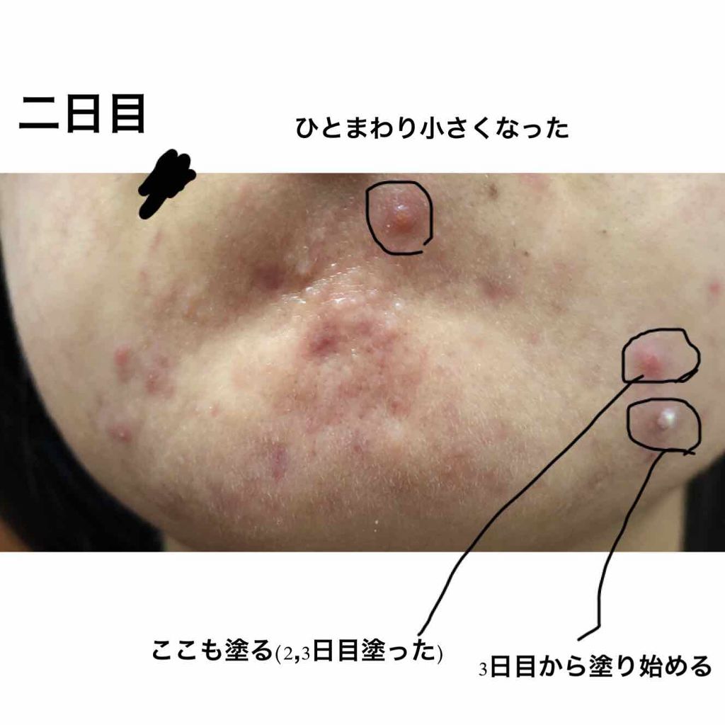 スキンケアセット（とてもしっとり）/IHADA/トライアルキットを使ったクチコミ（3枚目）