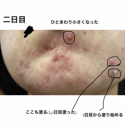 スキンケアセット(とてもしっとり)/IHADA/トライアルキットを使ったクチコミ(3枚目)