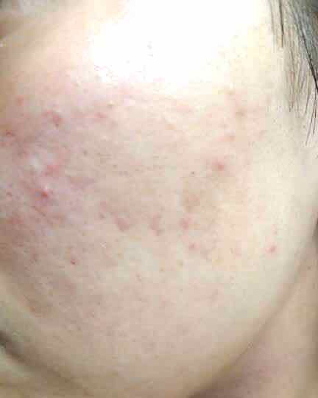 colorful_make_1ee on LIPS 「肌荒れって嫌ですよね。乾燥や汚れ,花粉による肌荒れをいっきに解..」(1枚目)