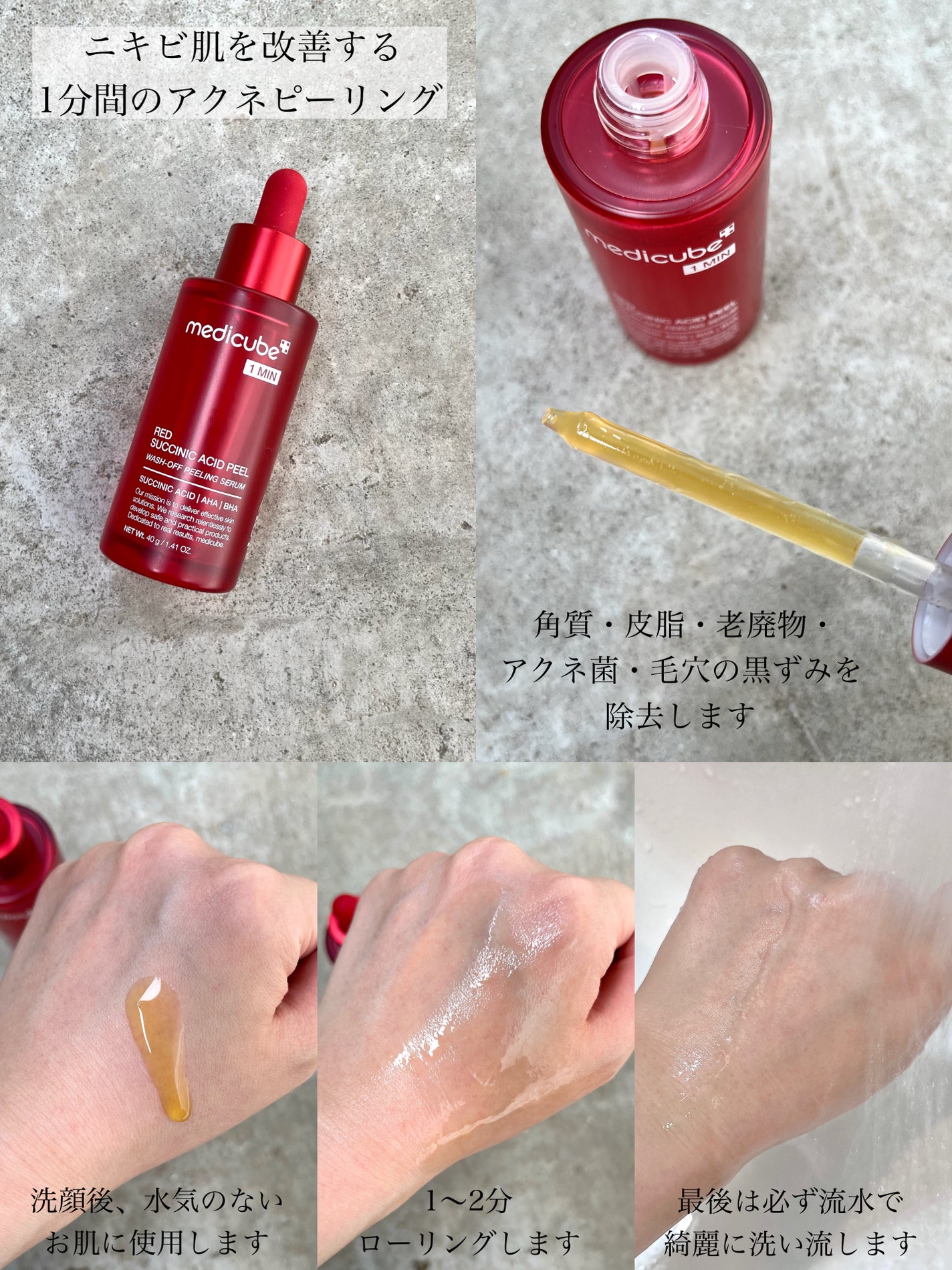 tomomi|コスメレビュー on LIPS 「ニキビ肌を撃退👊🏻ピーリング&鎮静ケアの2ステップで徹底的にケ..」(2枚目)