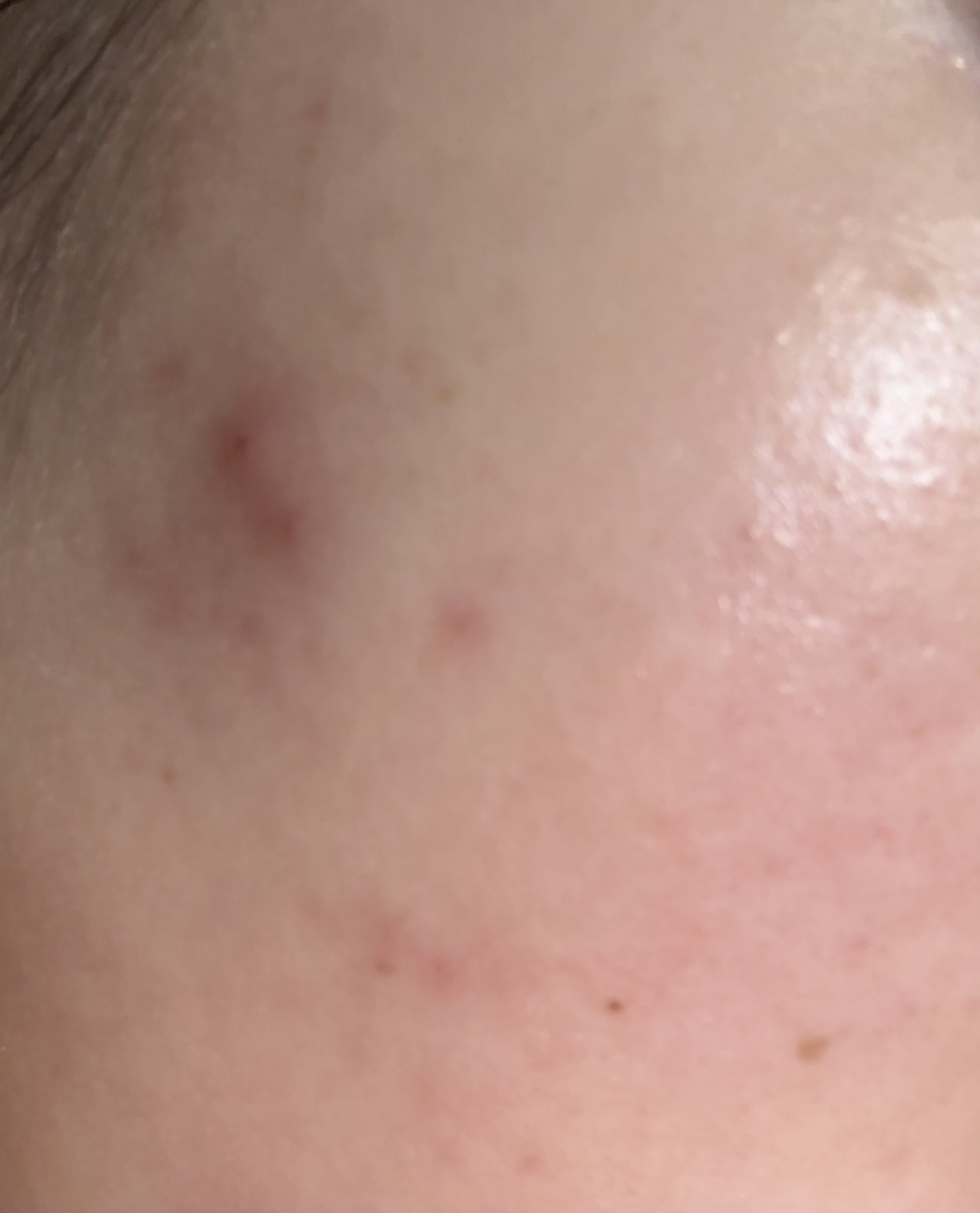 ルルルン ハイドラ AZ マスク/ルルルン/シートマスク・パックを使ったクチコミ（2枚目）