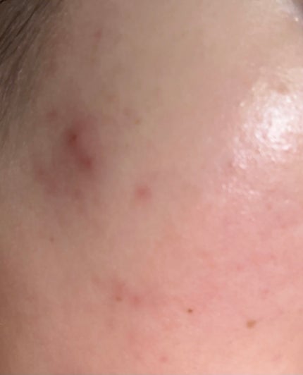 ルルルン ハイドラ AZ マスク/ルルルン/シートマスク・パックを使ったクチコミ(2枚目)