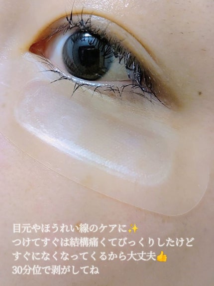 W+ マイクロ ニードル パッチ/SNP/アイケア・アイクリームを使ったクチコミ(3枚目)