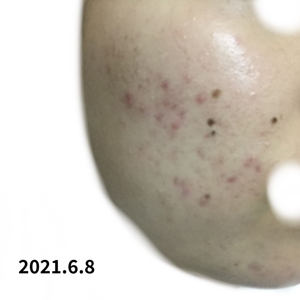 デュオ ザ クレンジングバーム クリア/DUO/クレンジングバームを使ったクチコミ（2枚目）