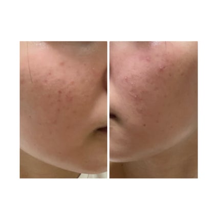 を使ったクチコミ(2枚目)