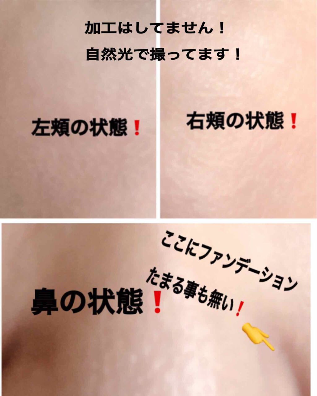 薬用しみ対策 美白ミスト化粧水/メラノCC/ミスト状化粧水を使ったクチコミ（2枚目）