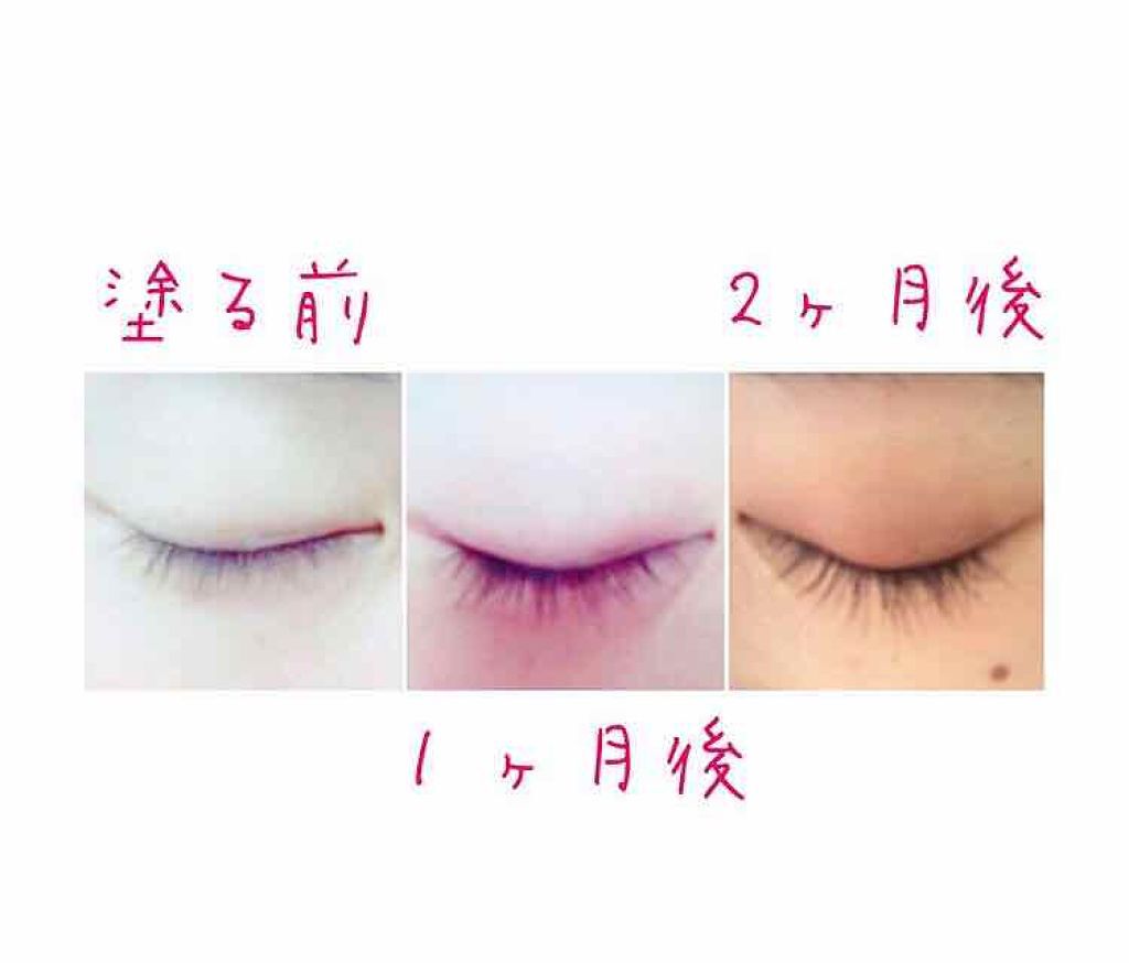 EMAKED(エマーキット)/水橋保寿堂製薬/まつげ美容液を使ったクチコミ(2枚目)