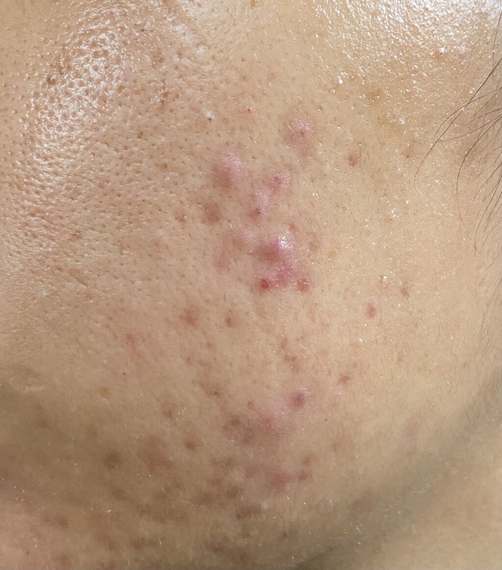 ホホバオイル/無印良品/ボディオイルを使ったクチコミ（3枚目）