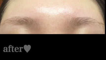 ジョレン クリーム ブリーチ/ジョレンジャパン/ムダ毛ケアを使ったクチコミ(5枚目)