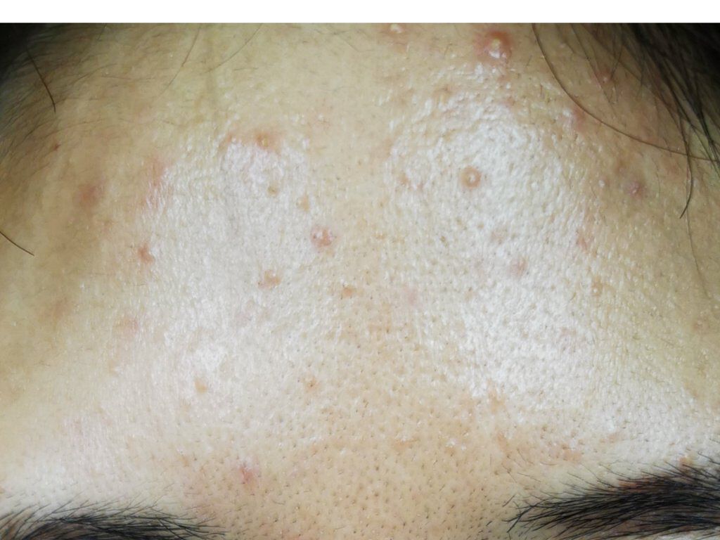 薬用美白ファンデーションSPF50+/ONLY MINERALS/ルースパウダーを使ったクチコミ(4枚目)