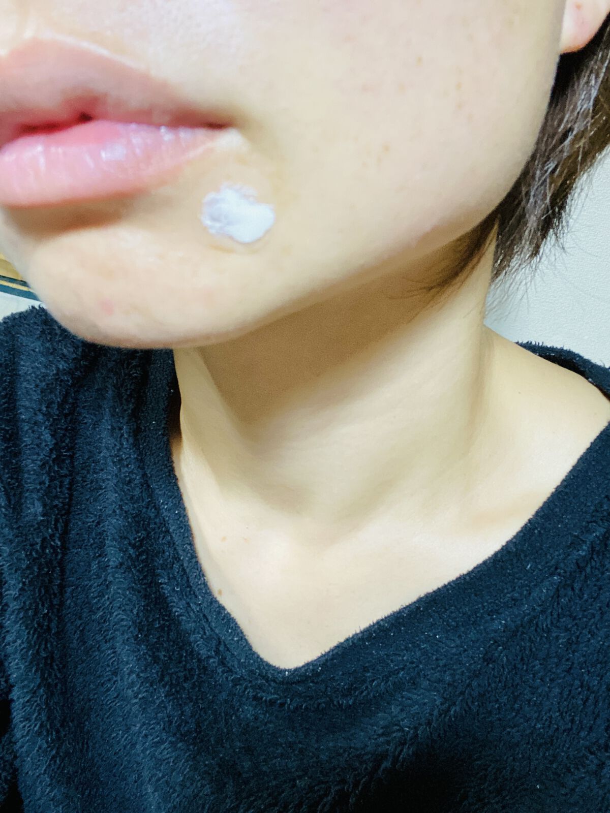 薬用ニキビケア スポッツクリーム/アクネスラボ/フェイスクリームを使ったクチコミ（3枚目）