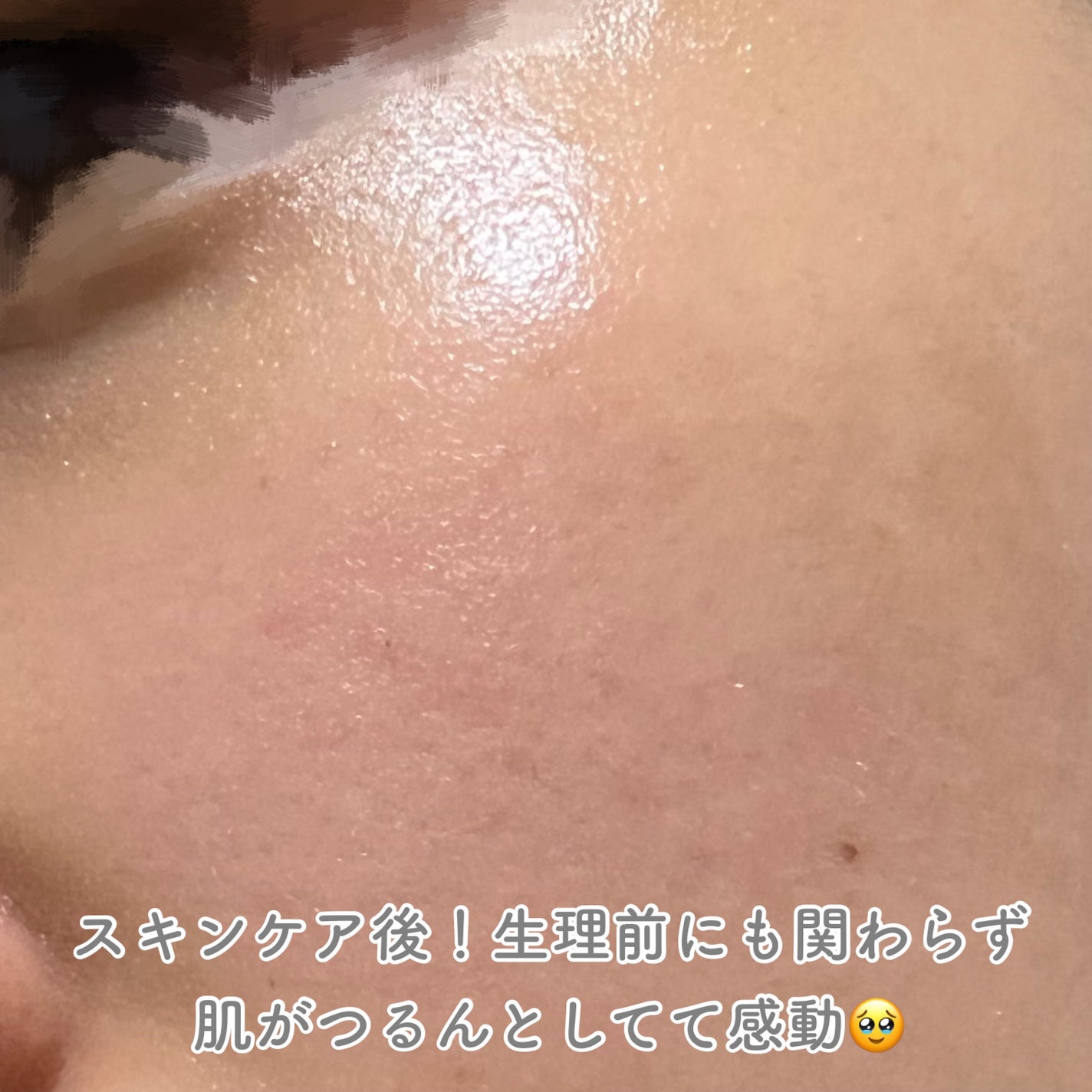 リードルショット300/VT/美容液を使ったクチコミ(6枚目)