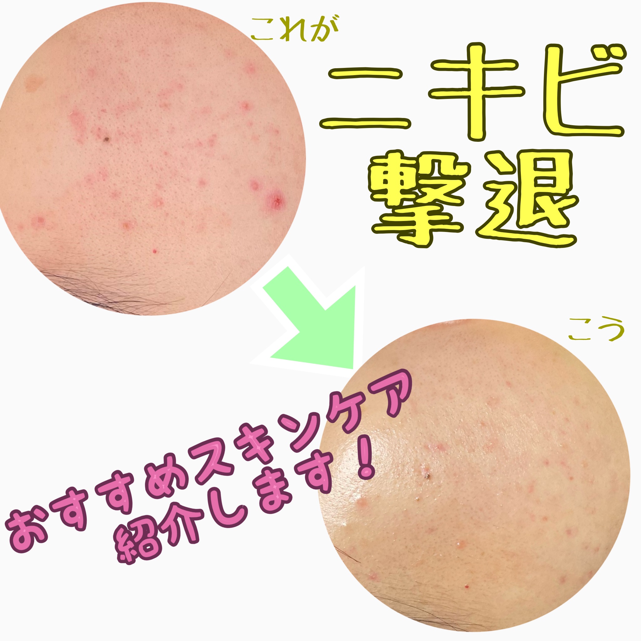 導入化粧液/無印良品/ブースター・導入液を使ったクチコミ（1枚目）