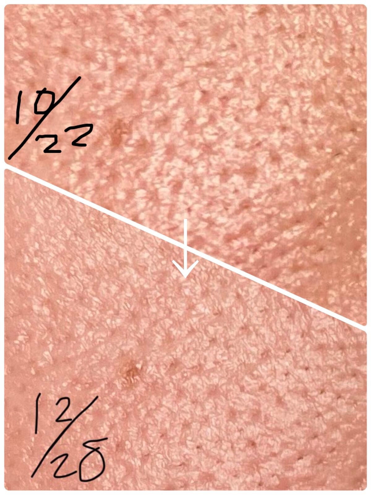 ガラクナイアシン2.0エッセンス/manyo/美容液を使ったクチコミ(3枚目)