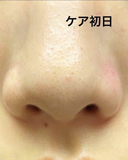 ディープピュア洗顔料/ダヴ/洗顔フォームを使ったクチコミ(2枚目)