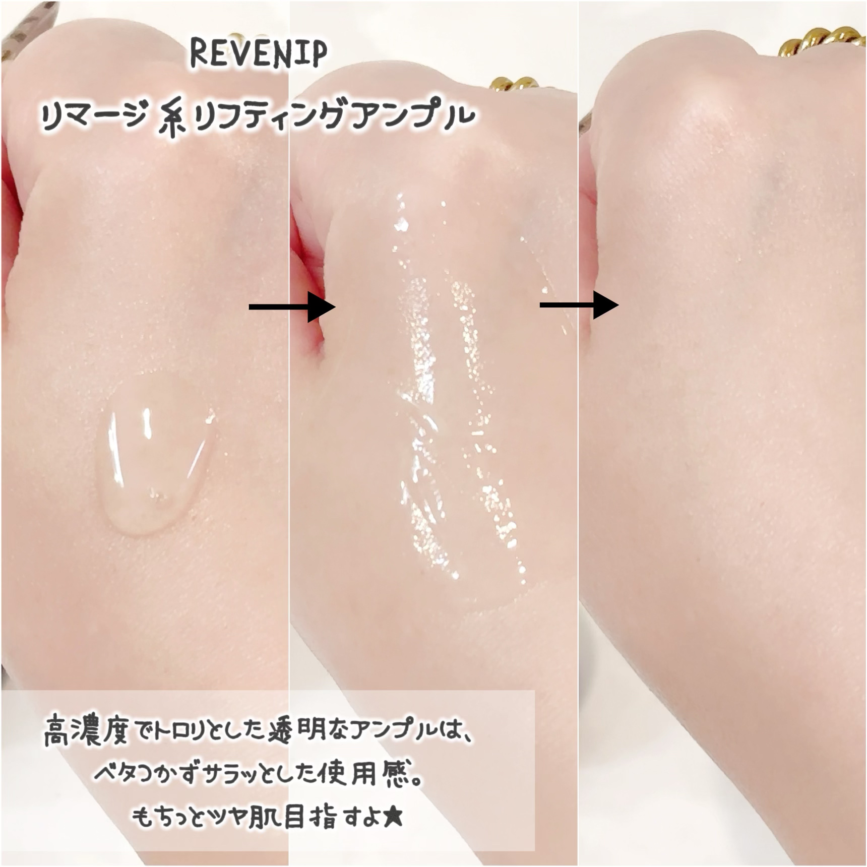 リマージ糸リフティングアンプル/REVENIP/美容液を使ったクチコミ（3枚目）