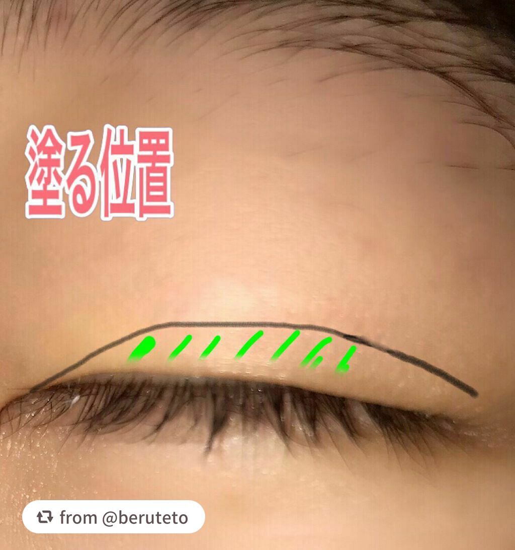 アイトーク/アイトーク/二重まぶた用アイテムを使ったクチコミ(5枚目)