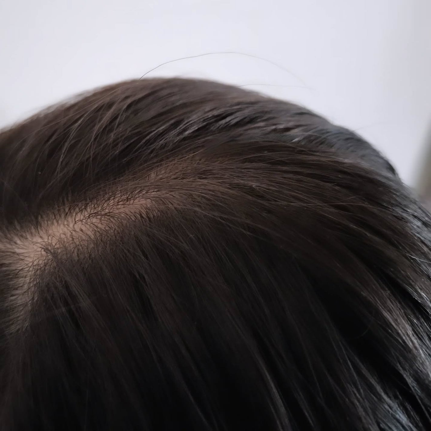 薬用スカルプセラム/wicot/頭皮ローションを使ったクチコミ(5枚目)