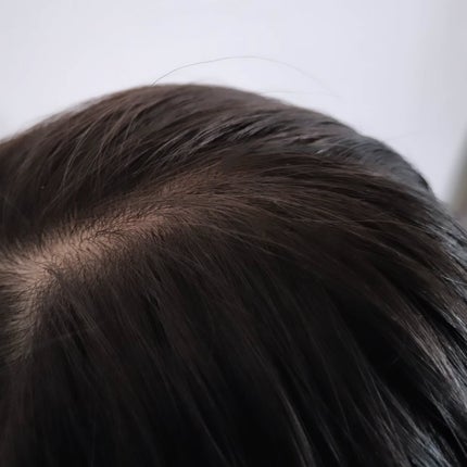 薬用スカルプセラム/wicot/頭皮ローションを使ったクチコミ(5枚目)